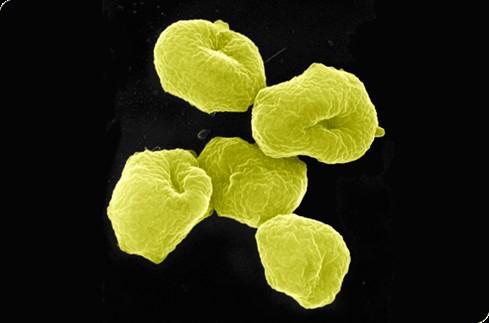 Gli Archaea sono una suddivisione sistematica fondamentale, al più basso livello, della vita cellulare.