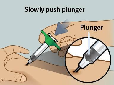 8) Inserire l ago Tenendo la siringa inclinata con un angolo di circa 45 gradi rispetto al sito di iniezione, inserire l ago nella pelle con un movimento rapido e deciso.