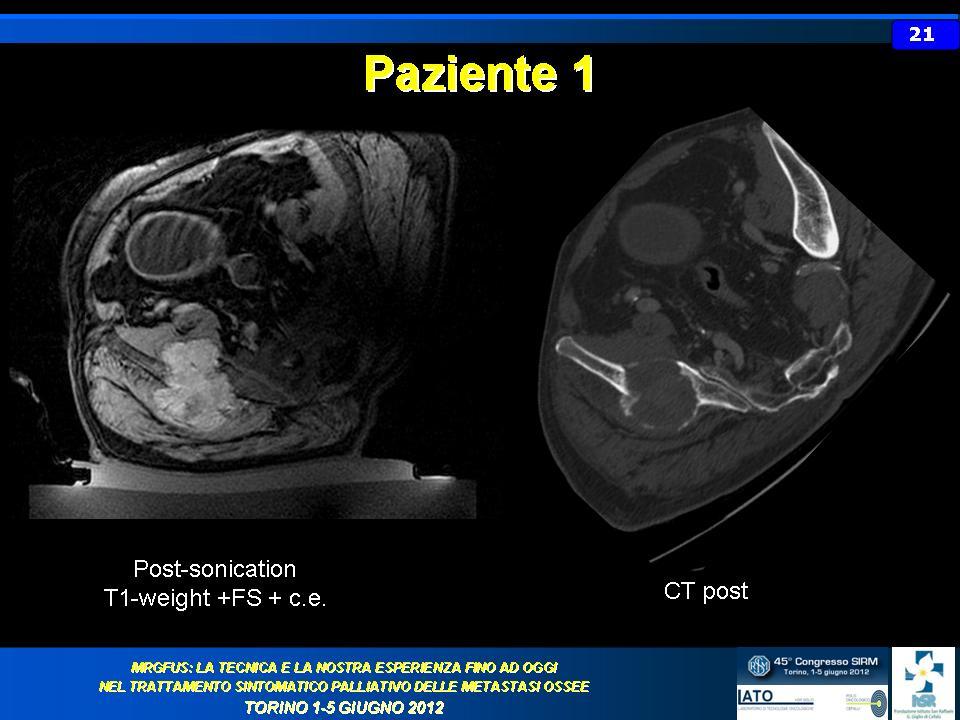 slide 22