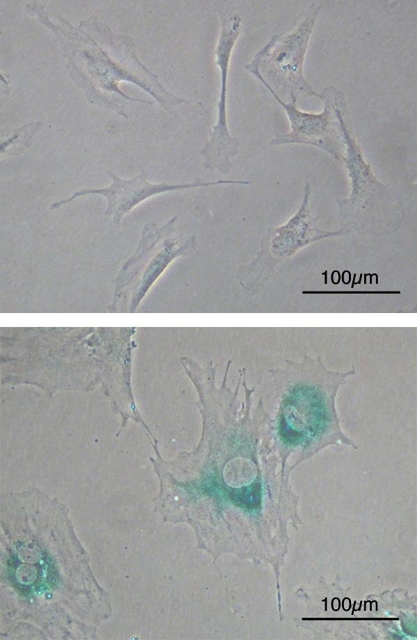 Si parla di REPLICATIVE SENESCENCE quando una normale cellula si è divisa un certo numero di volte (questo numero varia a seconda del tipo di cellula e dalle condizioni esterne), i telomeri diventano