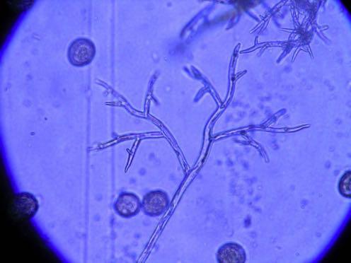 000 specie di nematodi A livello produ4vo, le perdite di produzione causate da patogeni e parassi2 sono molto alte 50%