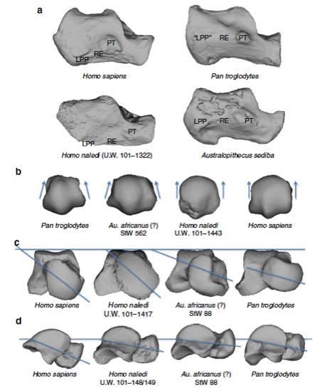 Fig. 22 (a) L anatomia del calcagno di H.