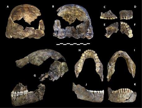 Fig. 11 DH1. (A) visione posteriore e (B) frontale dell osso occipitale U.W.