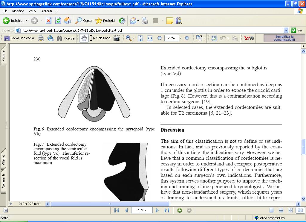 Type Va contro-lateral