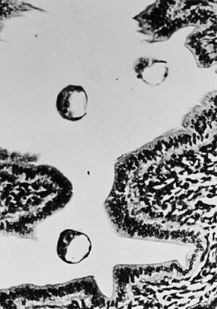 (integrine) Secrezione di proteasi BLASTOCISTI