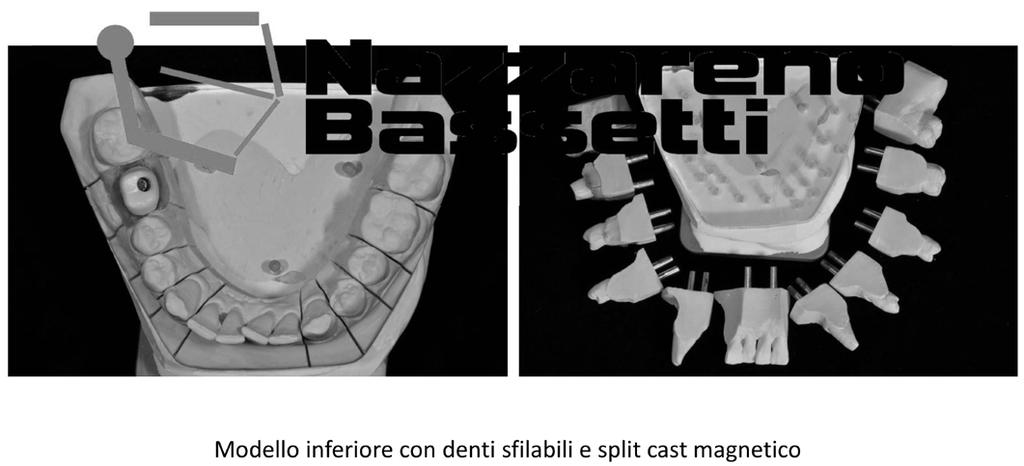 MATERIALI NECESSARI PER LA PRATICA Elenco Materiali MODELLI DELLA PROPRIA BOCCA