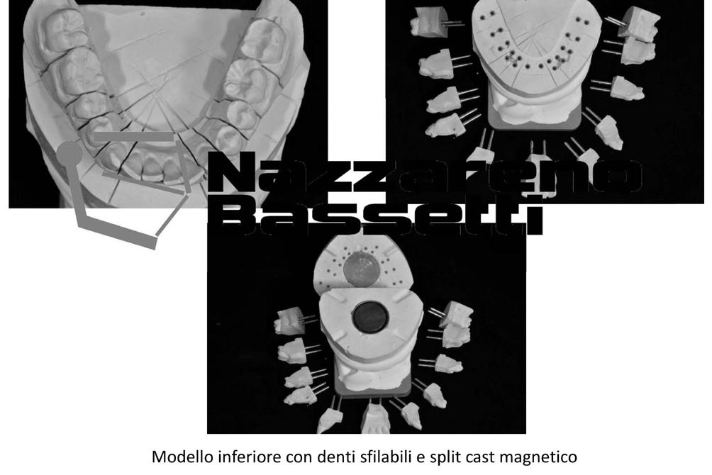 Modello arcata superiore con split cast magnetico (vedi foto dei modelli) 2.