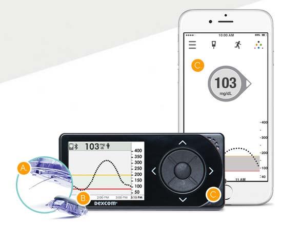 DEXCOM G5