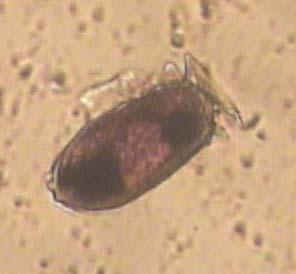 Fig. 24. Dinophysis sacculus. Tab. 9.