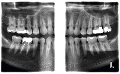 diagnostico Maggiore superficie