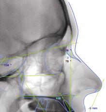 Planmeca ProMax 2D Cefalometria di qualità per l ortodonzia Offriamo attrezzature eccezionali e