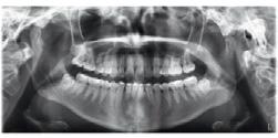 diverse esigenze radiografiche.