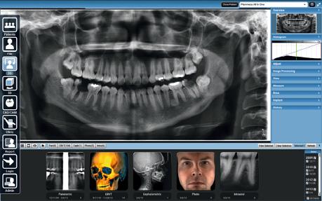 Questa suite flessibile per l imaging dentale si adatterà alle vostre esigenze e si svilupperà nelle immagini 3D del vostro studio.