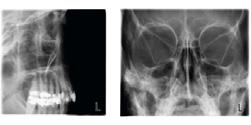 Ideale per l imaging parodontale e la pianificazione degli impianti.