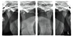 I programmi per ATM multiangolare producono radiografie con immagini provenienti da tre diverse angolazioni, sia dalle proiezioni laterali, sia dalla proiezione PA.