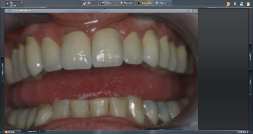 Sirona Dental Systems GmbH Plugin video per SIDEXIS 4 TENEO / SINIUS / INTEGO 3 Uso 3.
