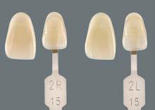 VITA AKZENT Plus Impiego BODY STAINS Adattamento del colore dei denti Utilizzando i colori complementari è possibile adattare la tonalità.