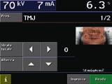 In caso di funzionamento anomalo, il sistema di controllo visualizza anche messaggi d errore. Questi vengono memorizzati in un error log che aiuta l operatore e il tecnico di assistenza.