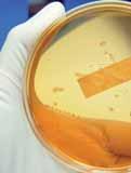 L esposizione a batteri resistenti agli antimicrobici (AMR) rappresenta un pericolo biologico emergente che ogni anno uccide migliaia di cittadini europei.