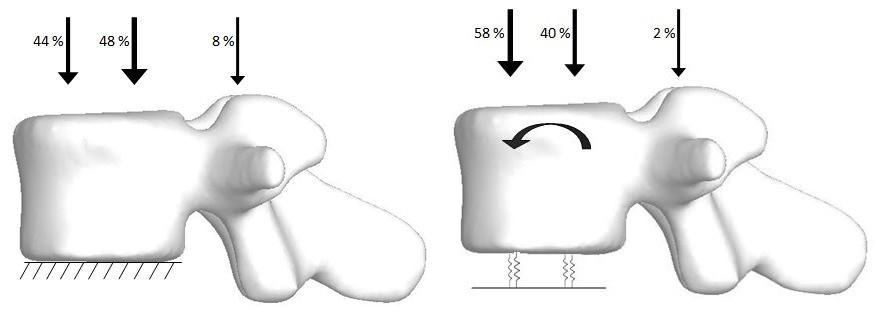 e il 2% sui peduncoli. In questo caso il pre-carico è stato applicato lungo la direzione cranio-caudale (direzione z) in maniera distribuita sulle rispettive superfici.