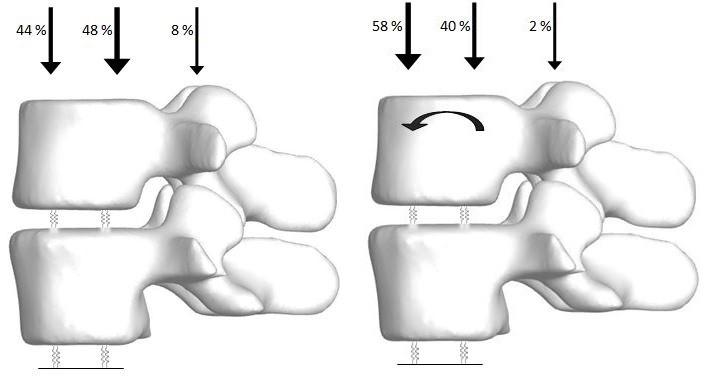 Fig. 15: condizioni di carico e vincolo per il segmento vertebrale in postura eretta (sinistra) e flessione antero-posteriore (destra) 2.