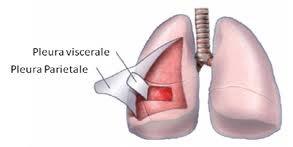 Mesotelioma della pleura Tumore altamente maligno della membrana di rivestimento del polmone (pleura) fortemente associato alla esposizione a fibre di amianto anche per basse dosi.