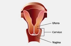 TUMORE DELLA CERVICE UTERINA (collo dell utero) Il tumore della cervice era la 3 neoplasia più frequente dopo seno e colon-retto.
