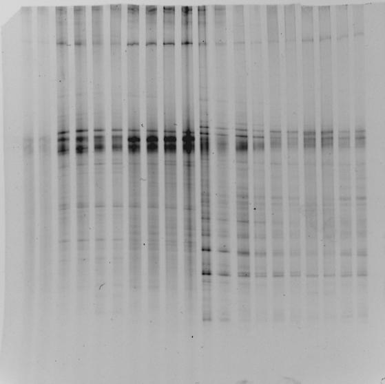 2007) di tipologia diversa (Pascolo, Erbaia, Sughereta, Vigneta inerbita, Vigneta lavorata) mediante fingerprinting genetico (16S rdna-pcr- DGGE)