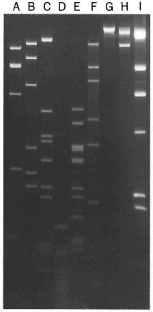 _ Separazione di frammenti di DNA mediante