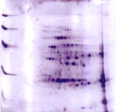 spectrum MALDI-TOF Capillary Electrophoresis HPLC GCG