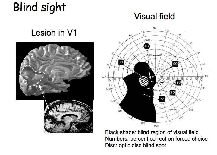 Ad alcuni soggetti affetti da lesioni dell area visiva primaria (V1) sono sottoposti diversi compiti