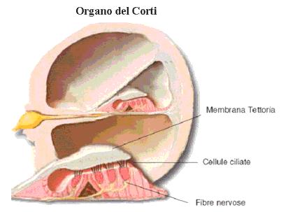 Il fenomeno della distorsione, che prende il nome di Rcruitment, è sempre presente, ad indicare la sede cocleare del danno.