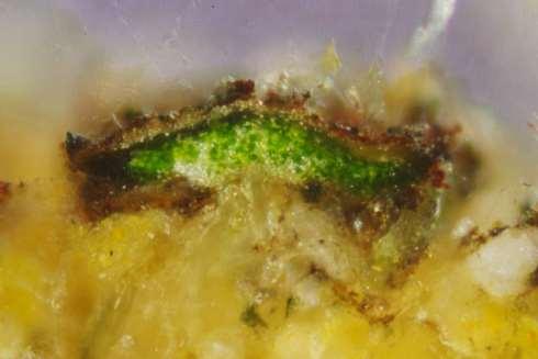 Si tratta di una foto olto didattica in quanto perette di individuare i costituenti anatoici del lichene