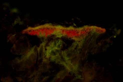 100 Foto n. 11. Altra foto all ultravioletto di un secondo lichene. U.