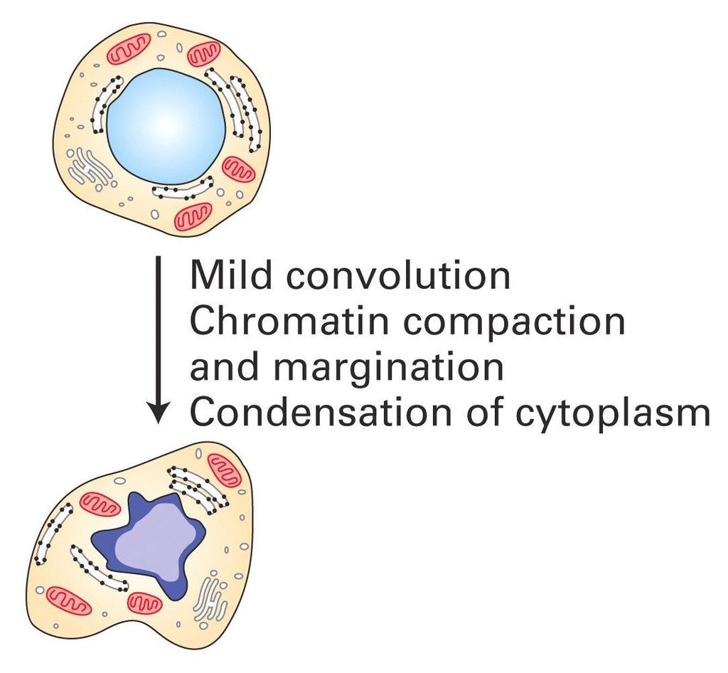 CAMBIAMENTI CELLULARI ASSOCIATI CON L APOPTOSI - Il citoplasma condensa e la membrana cellulare si ripiega, le proteasi inziano a tagliare i