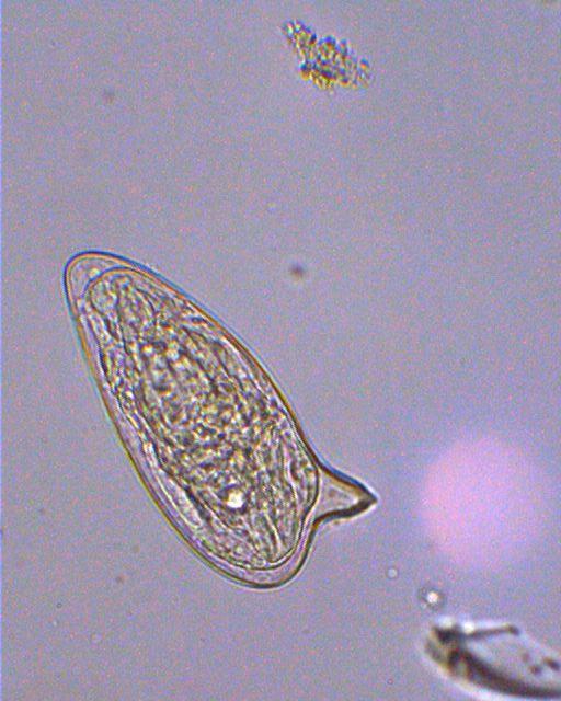 Schistosoma spp.