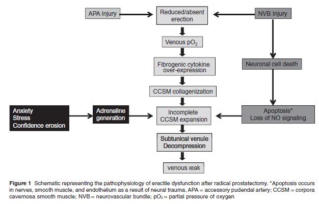 Fisiopatologia della DE post RP Per facilitare la comprensione del recupero della EF post RP da parte dei