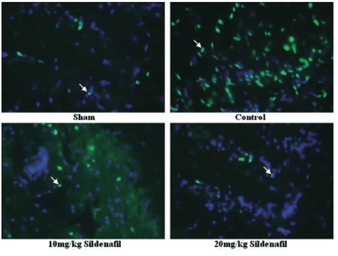 Riabilitazione peniena PDE5-Is riducono apoptosi dopo danno ai nervi cavernosi La somministrazione daily di PDE5-I ha mostrato chiari benefici in modelli animali di ED