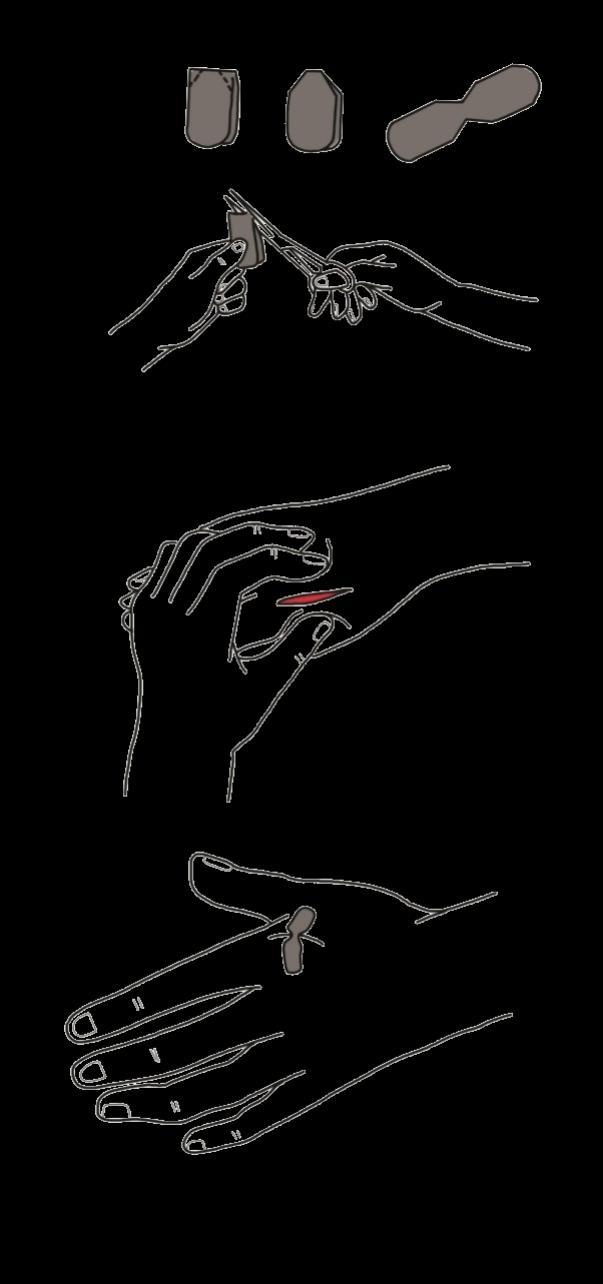 Per le piccole ferite da taglio con bordi lineari, si può utilizzare la tecnica del cerotto a farfalla: dopo aver disinfettato la ferita, si avvicinano i