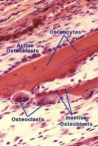 Cellule dell osso Osteoblasti: - Attivi - Inattivi