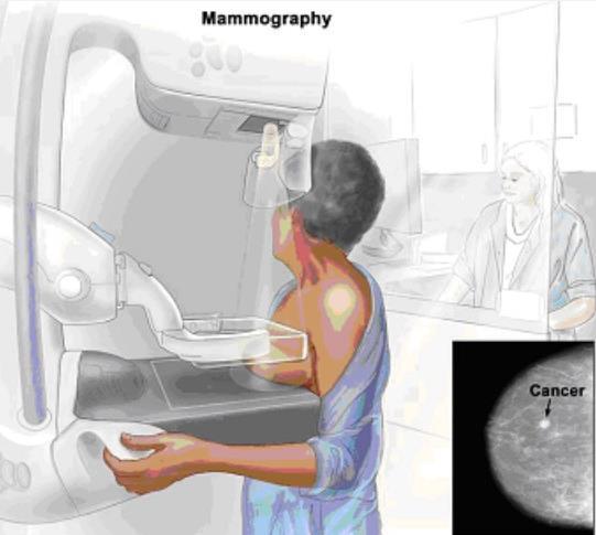 La possibilità di eseguire una mammografia non è prevista in tutti gli ospedali regionali ma la cosa più grave è che l accessibilità a questa