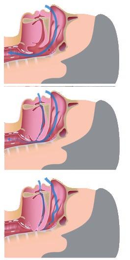 L iter medico prevede: esame poligrafico o polisonnografico - che si esegue in Clinica -, con il quale il Medico del Sonno (Neurologo o Pneumologo) individua il disturbo esami di laboratorio