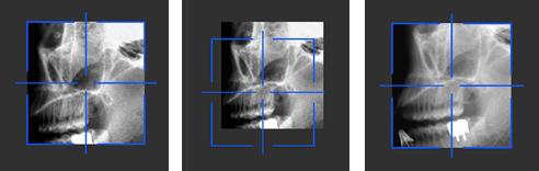 Live Positioning Assistant IMAGING 3D L utente può visualizzare e regolare la posizione del FOV in modo virtuale sul paziente La vista scout