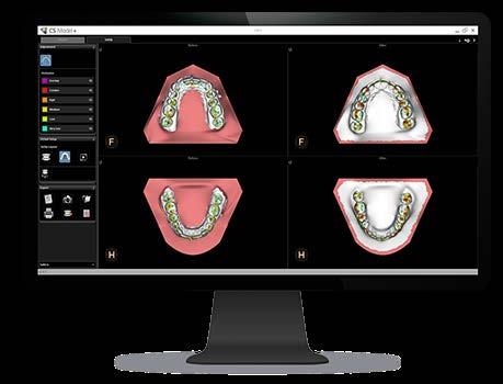 SCANSIONE FACCIALE 3D*