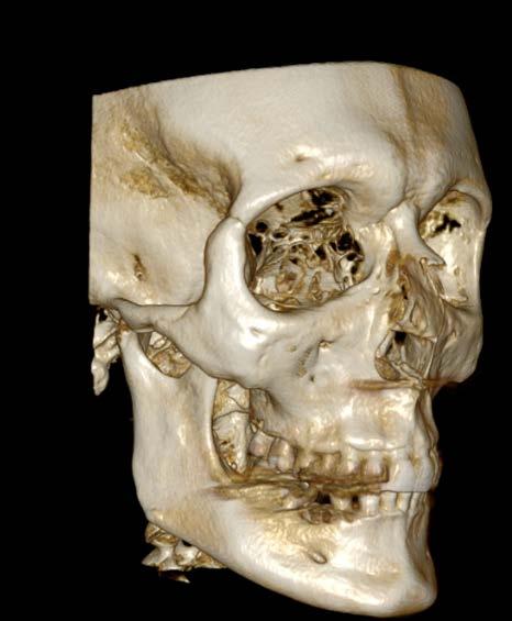 sui modelli 3D Aiuta il paziente a