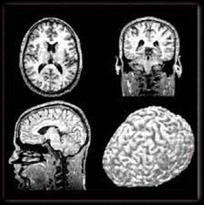 conclusione della valutazione neurologica Breve durata (30