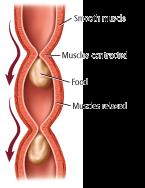 Stimolazione meccanica (stiramento)