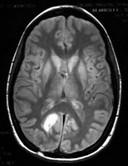 Riconoscimento di endofenotipi da analisi di dati di imaging Classificazione sani/malati: algoritmi di Data