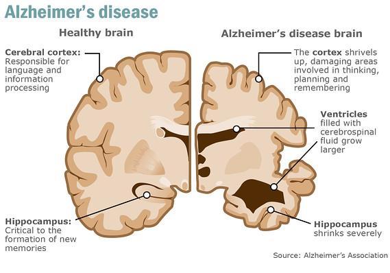 I RISULTATI DEI PRIMI 6 MESI DI ATTIVITA Chi è il residente Non malato di Alzheimer, né