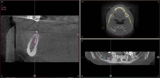 selezionare il modello di scanner utilizzato al